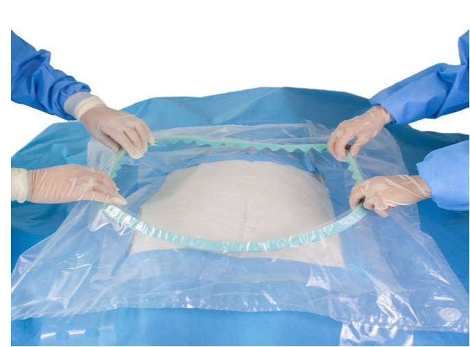 what is the C-section surgery packs